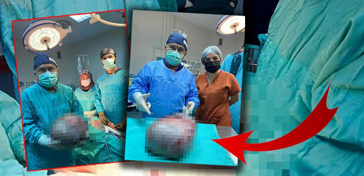 "Tam 8 kilo..." Karın ağrısı şikayetiyle geldi, karnından çıkanlar doktorları bile şaşırttı