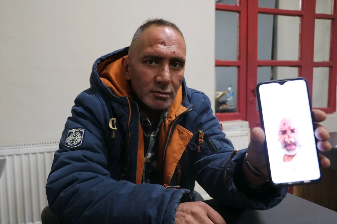 Afrika sineği hayatını kararttı! Genç adamın yüzü tanınmayacak hale geldi, vücudunda yaralar çıktı...