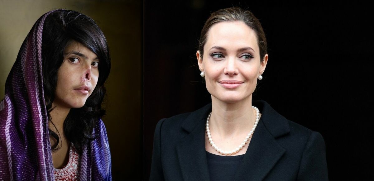 Taliban üyesi kocası tarafından burnu kesilen Bibi Aisha, yaşadıklarını Anjelina Jolie’ye anlattı!