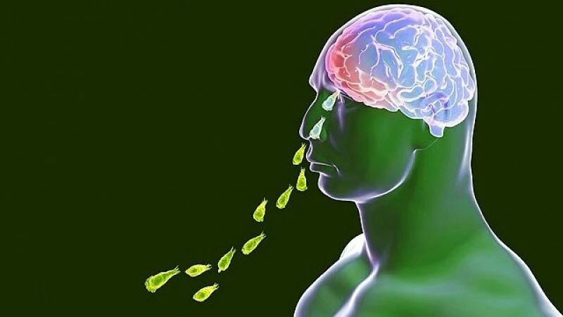 Musluk suyuyla burnunu yıkadı hayatını kaybetti! Beyin yiyen amip 1 haftada öldürüyor