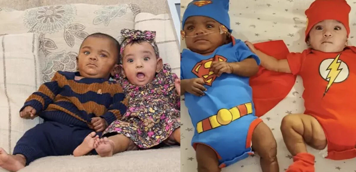 Guinness Rekorlar Kitabı Doktorlar yüzde 0 şans verdiler, doğar doğmaz <a href=