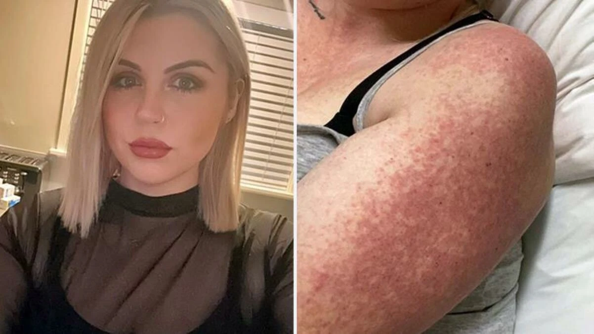 Vücudunda yaralar, derisinde pul pul dökülmeler kullandığı ilaçlardan oldu! Doktorlar bile şaştı