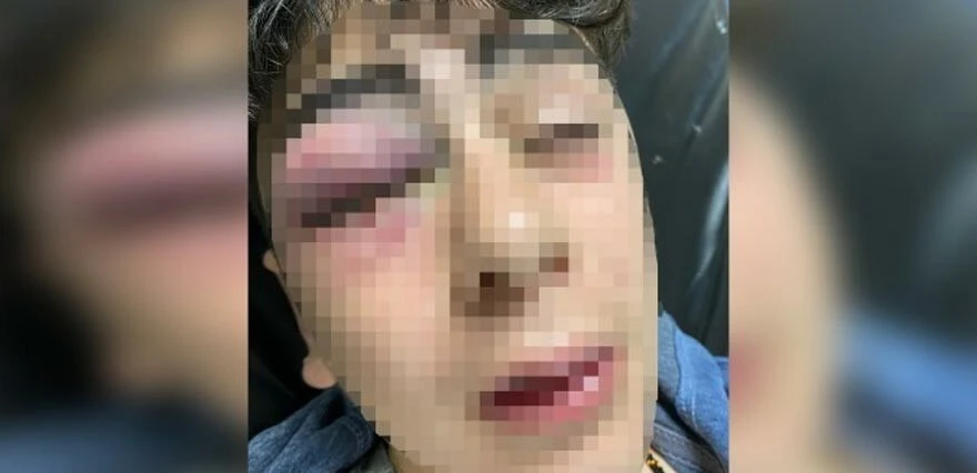 polis şiddeti Diyarbakır’da 14 yaşındaki çocuğa <a href=