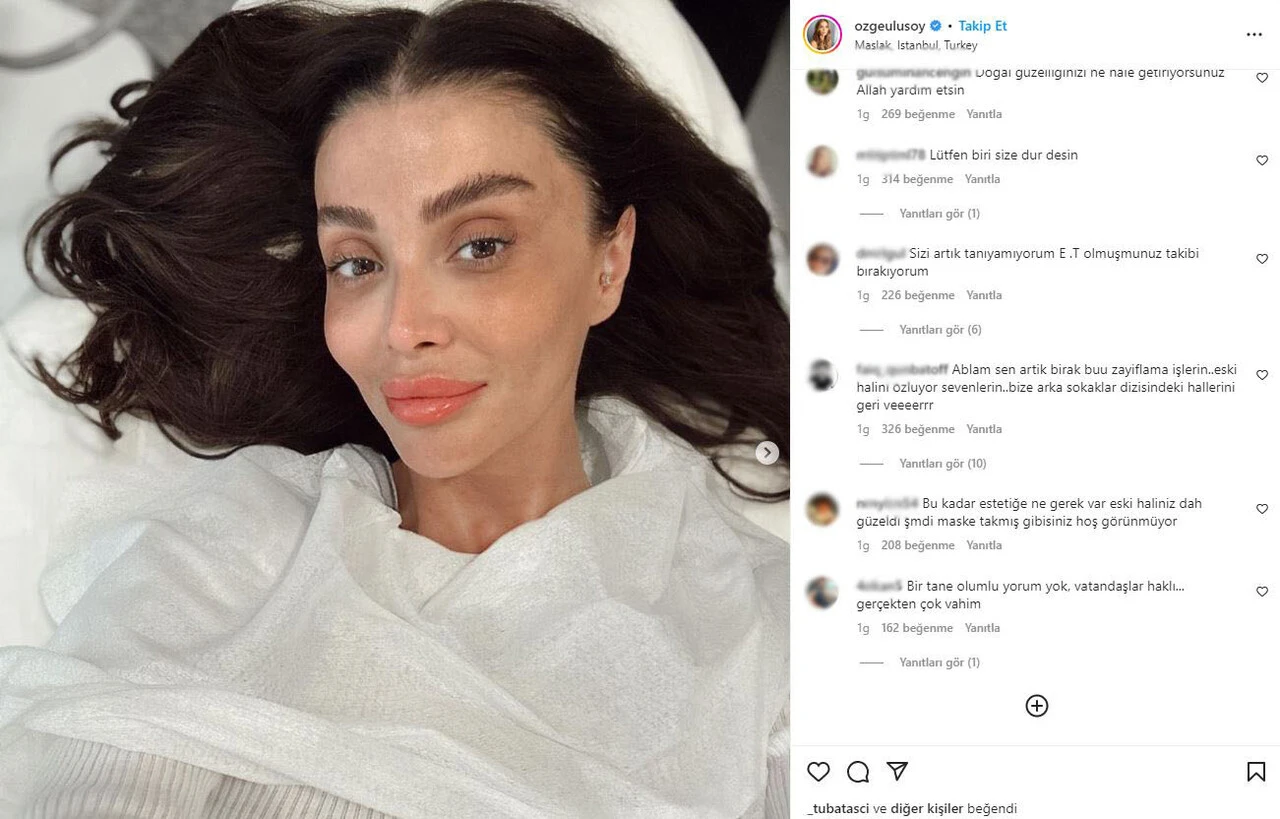 Gören şoke oldu: Özge Ulusoy’un son hali Dart Vader’e benzetildi!