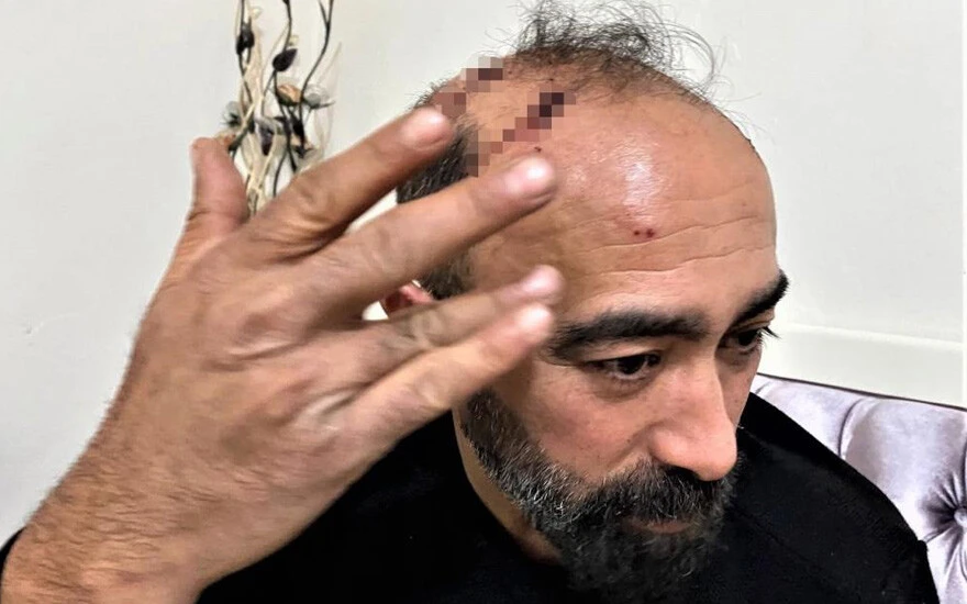 Taksiciye kaldırım taşı ile saldırmıştı! Cezası belli oldu