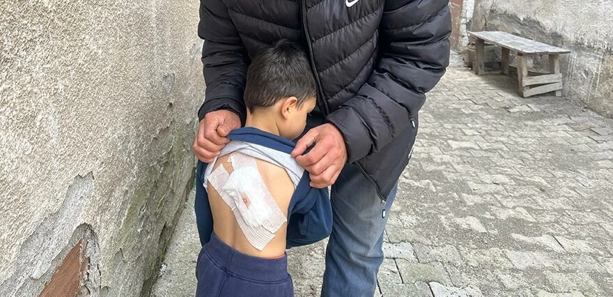 Bir köpek saldırısı daha: 4 yaşındaki çocuk ölümden döndü