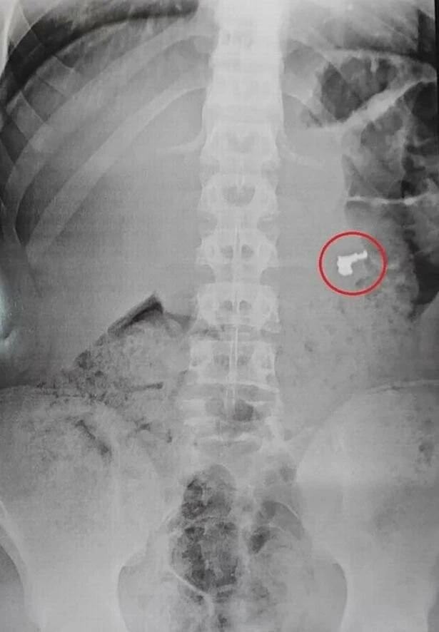 Bisikletli hırsızlar yakayı ele verdi! Altın kolyeyi sakladıkları yer şoke etti