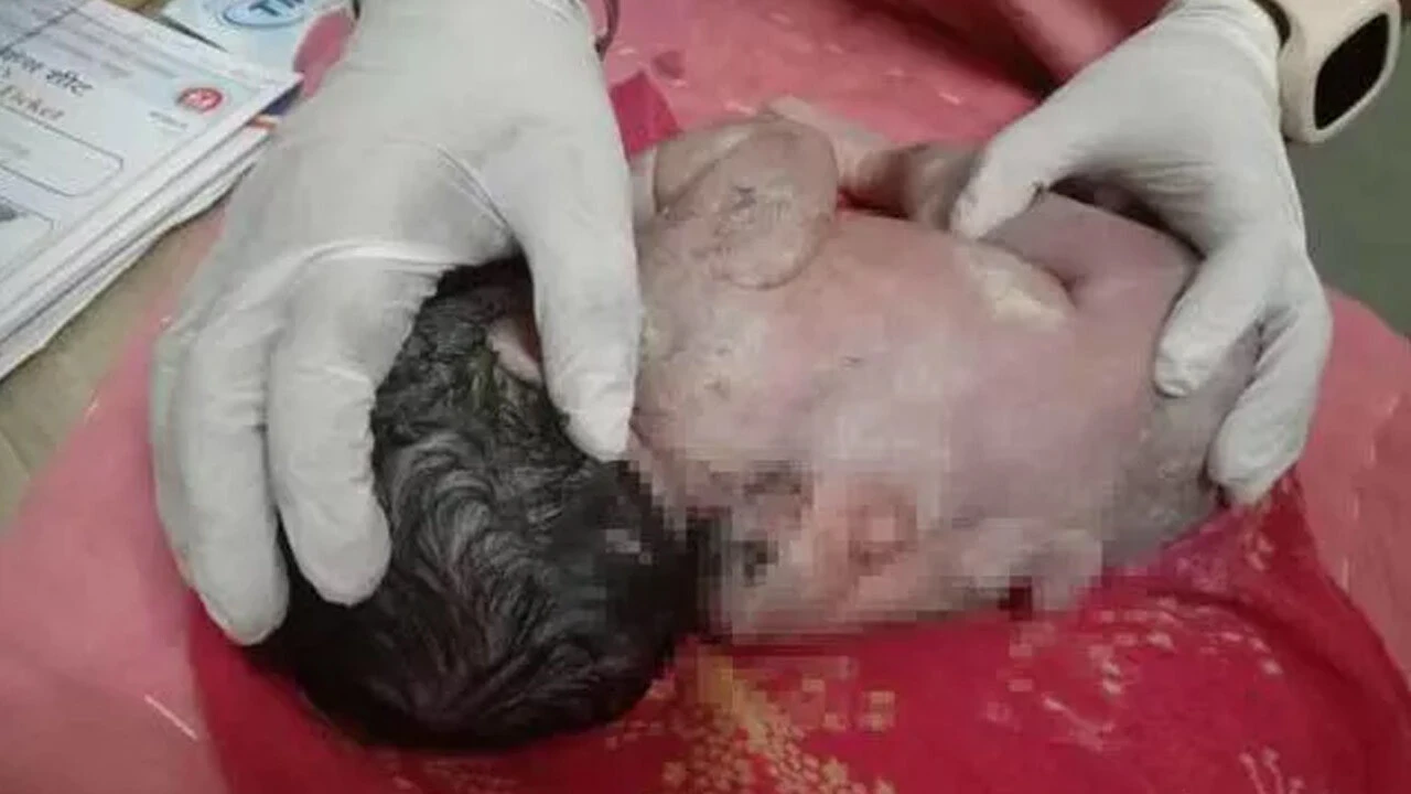 3 kollu doğan bebek herkesi şaşkınlığa uğrattı! Görmek için hastaneye akın ettiler