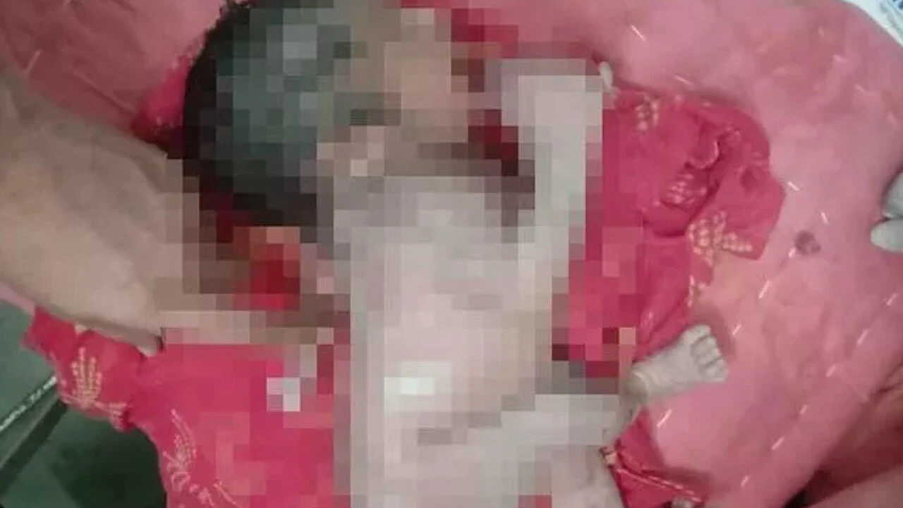 3 kollu doğan bebek herkesi şaşkınlığa uğrattı! Görmek için hastaneye akın ettiler