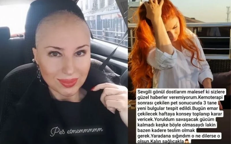 Savaşacak gücüm kalmadı demişti! Kanserle mücadele eden şarkıcı Hülya Bozkaya'ya destek yağdı!
