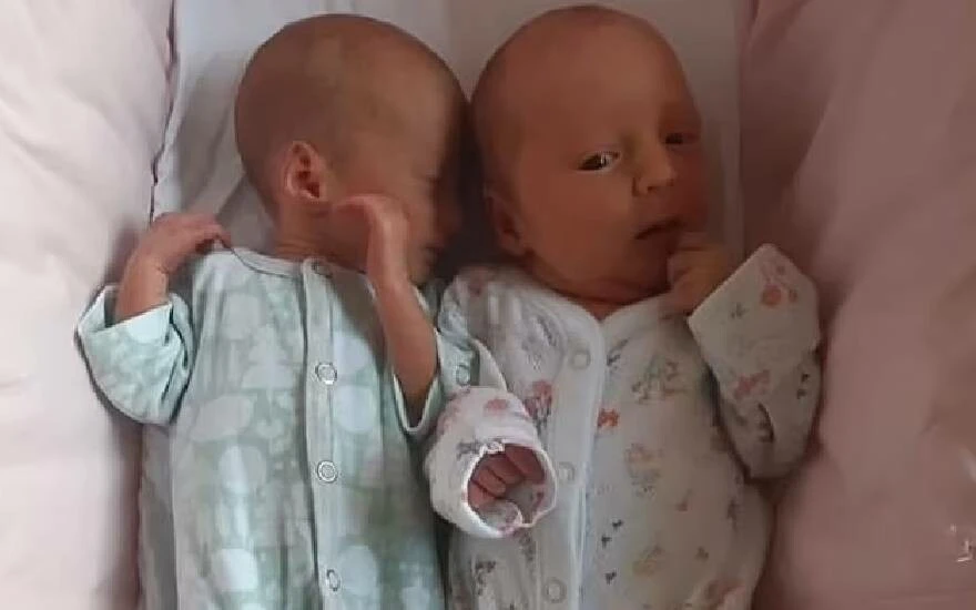 28 günde 2 kez hamile kaldı! Dünyada ender görülüyor