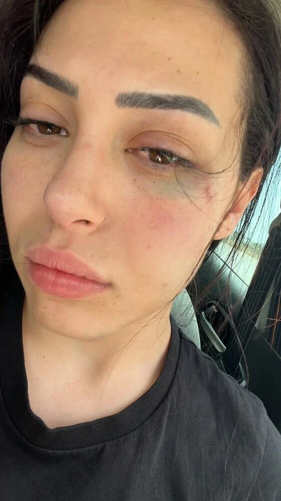 Güney Kıbrıs Rum Kesimi'nde Türk kızına saldırı! İki Rum saldırgan tutuklandı