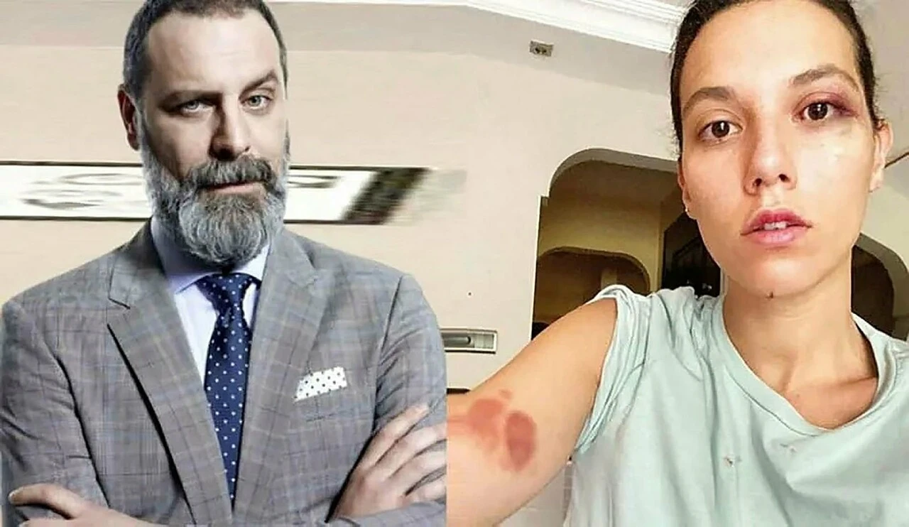 Bu dava nedeniyle setlere çıkmayacağını söylemişti! Ozan Güven'in şiddet davası 20 Haziran'da görülecek