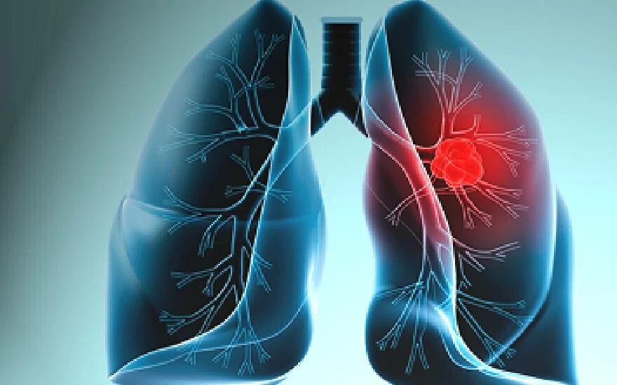 Erken Teşhis çok önemli! Hastalıkla mücadele en etkili silah….