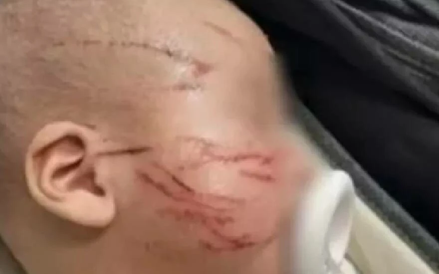 10 Haftalık bebeğe şiddet! Anne soluğu karakolda aldı...