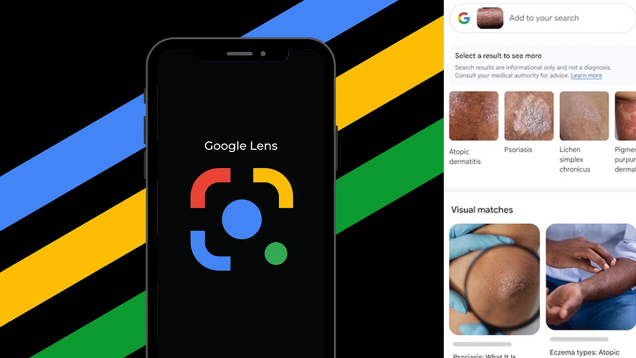Google’dan bomba yenilik… Cildinizin fotoğrafını çekerek hastalığınızı öğrenebileceksiniz