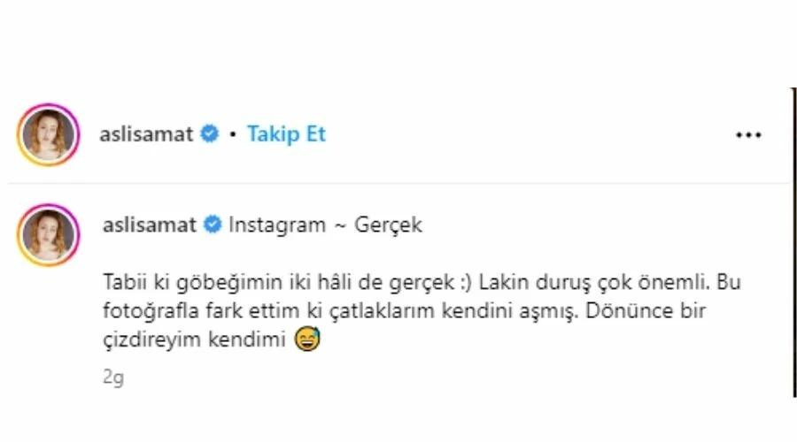 108 kilo veren Aslı Samat yaz sezonunu açtı! Vücudundaki çatlaklar için söyledikleri herkesi güldürdü...