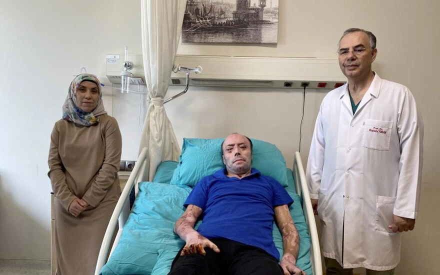 Maden faciası sonrası 8 ay hastanede kaldı: 140 ameliyat ile taburcu oldu