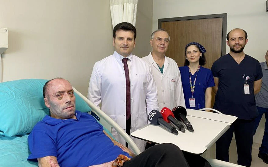 Maden faciası sonrası 8 ay hastanede kaldı: 140 ameliyat ile taburcu oldu