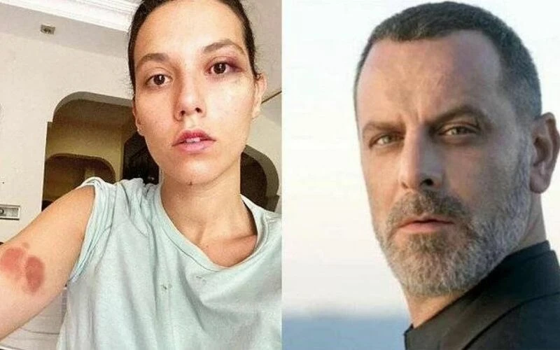 Şiddet davasında son durum! Ozan Güven’in photoshop iddiası boşa çıktı