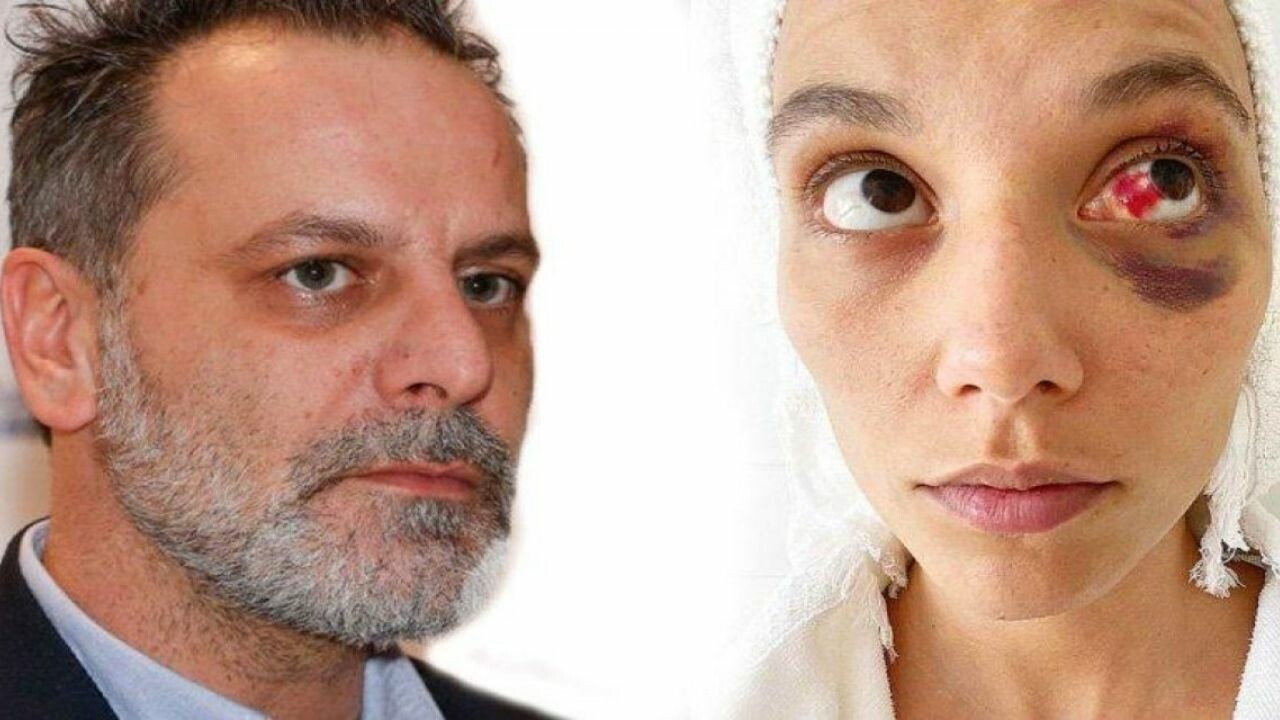 Şiddet davasında son durum! Ozan Güven’in photoshop iddiası boşa çıktı