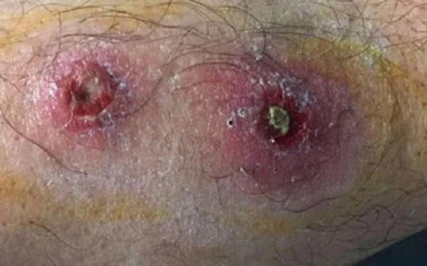 Samsun'da şarbon alarmı! Hayvan kesilmesi yasaklandı