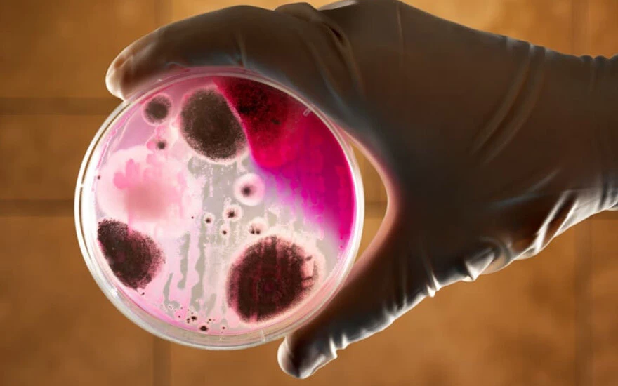 Samsun'da şarbon alarmı! Hayvan kesilmesi yasaklandı