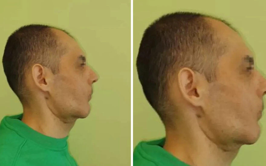 Hayatı zindan oldu! Yeni yüzüne kavuştu… Adeta yeni doğmuş bir bebek gibi hissediyor