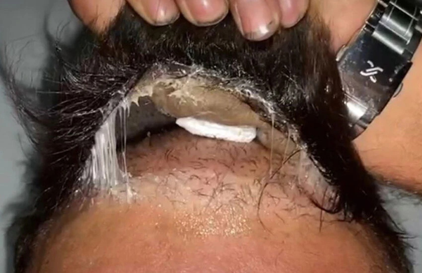 Peruğun altından uyuşturucu çıktı.