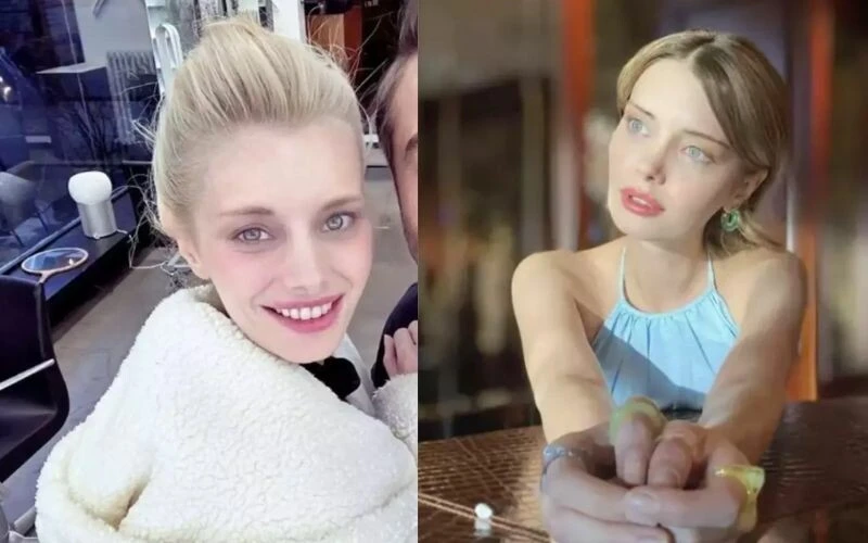 Estetiğin dozunu fazla kaçırdı! Ufak Tefek Cinayetler’in Yıldız’ı son haliyle şoke etti…