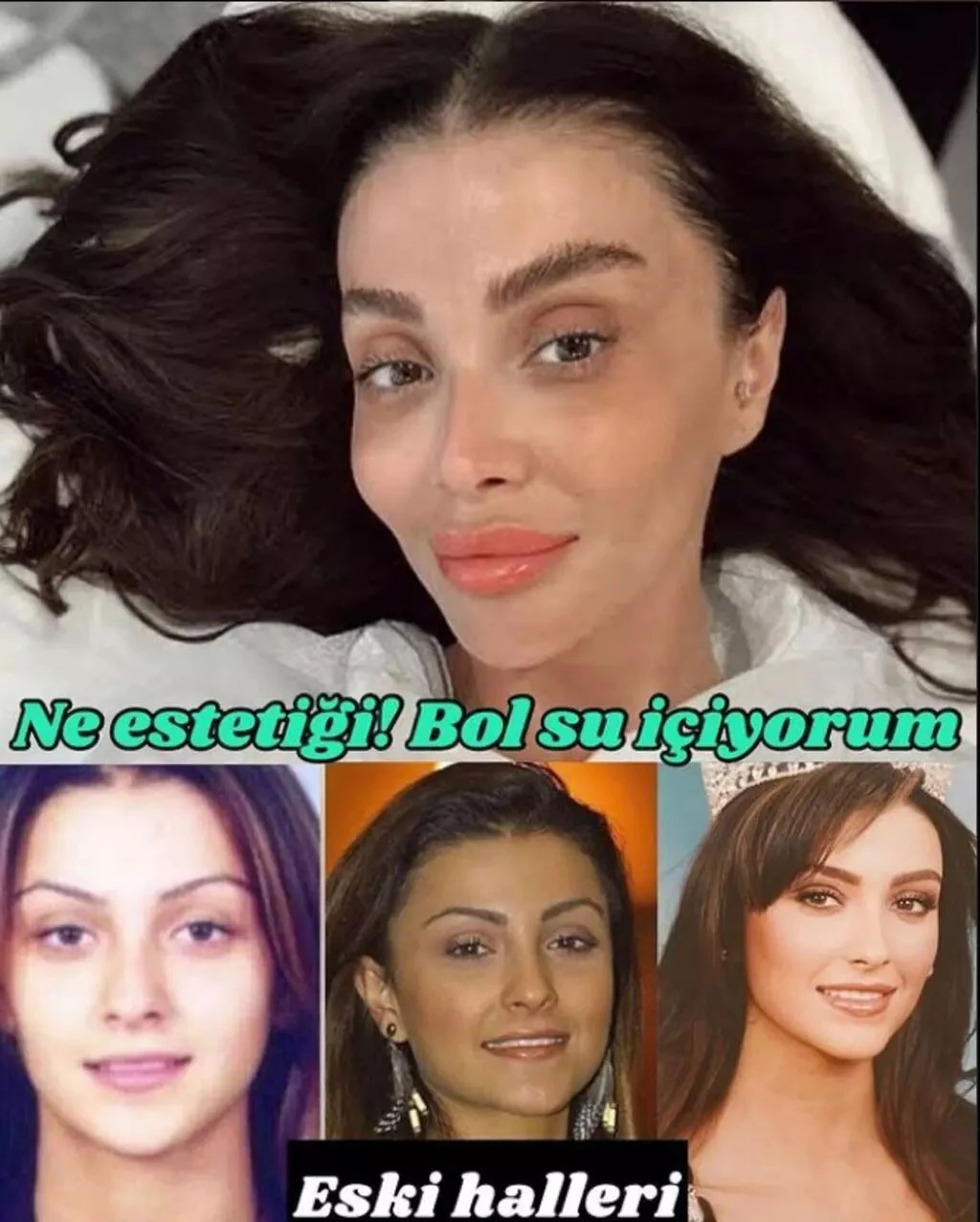 Doğal olduğunu iddia etti! Özge Ulusoy’un güzellik sırrı alay konusu oldu