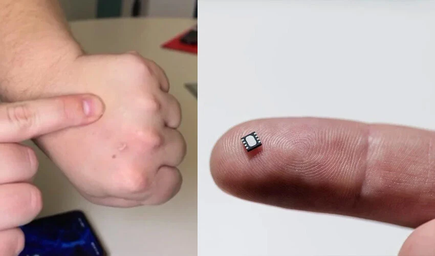 Hesabı parmaklarıyla ödüyor! Mikroçipleri deri altına implant ettirdi artık cüzdan taşımıyor