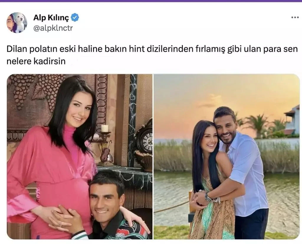 Dilan Polat ve eşinin eski hali ortaya çıktı, sosyal medyada yer yerinden oynadı!