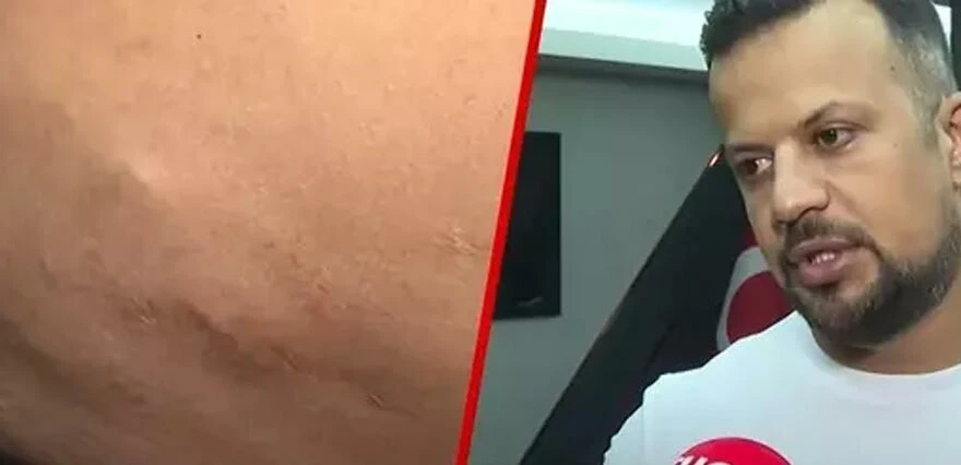 Zayıflayayım derken hayatı kabusa döndü! Yıllardır ağrılardan kurtulamıyor...