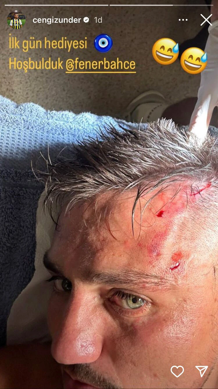 Cengiz Ünder'den talihsiz başlangıç