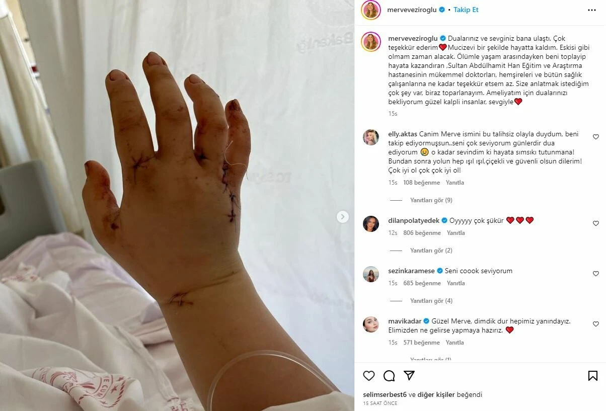 Eşi tarafından 32 kez bıçaklanan fenomenden ilk paylaşım!