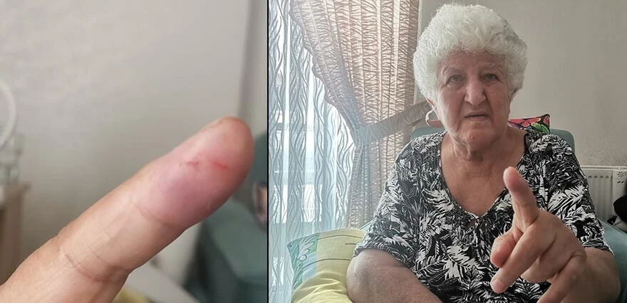 Kedi sanıp dokundu, kanlar içinde kaldı! Yaşlı kadının korku dolu anları...