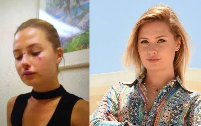 boşanma Takılarını bozdurup kumara vermiş! Sessizliğini bozan Chloe Loughnan, Serdar Ortaç’la <a href=