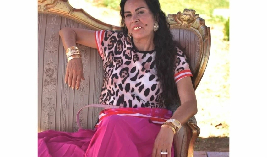 Nursel Köse'yi yeni imajıyla tanımak mümkün değil! Tüm dişleri altın kaplama oldu