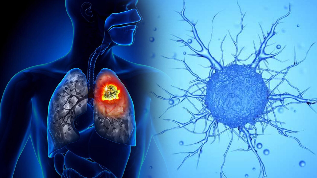 Kanser tedavisinde bir ilk: mRNA aşısı işe yaradı