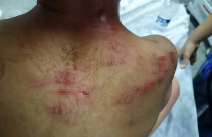 Sokak köpeği dehşet saçtı! Ölümde dönen çocuğun kafasına 25 dikiş atıldı