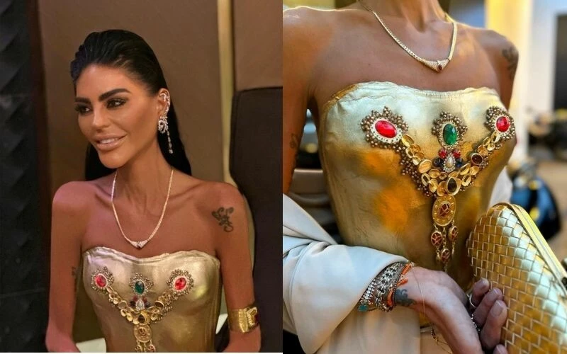 Zayıflıktan bir deri bir kemik kalmıştı! Süreyya Yalçın’ın altın elbisesinin fiyatı dudak uçuklattı…