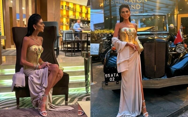 Zayıflıktan bir deri bir kemik kalmıştı! Süreyya Yalçın’ın altın elbisesinin fiyatı dudak uçuklattı…