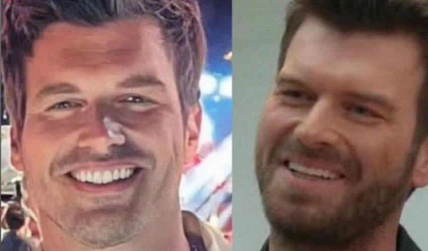 Kıvanç Tatlıtuğ bile ilk estetiğini oldu! Hayranları ikiye bölündü