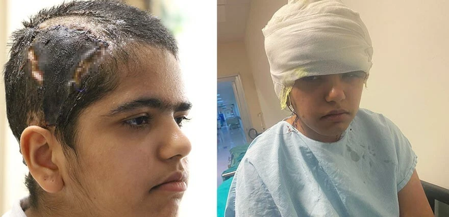 Go-kart faciası! Eğlenmek için bindi, saçı tekere dolanınca dehşeti yaşadı! Kafa derisi...