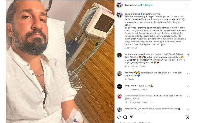 Şok seviyesinde alerjisi olan sebzeyi yedi… Barış Manço’nun oğlu Doğukan Manço hastanelik oldu!