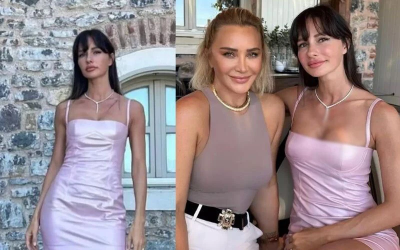 Yasemin Özilhan’ın son hali görenleri şoke etti! Estetiğin dozunu fazla kaçırdı…