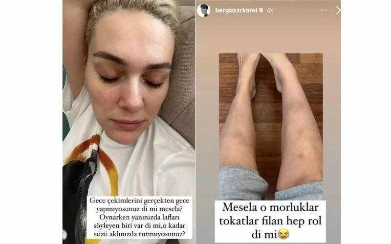 Oyunculuğun zorluklarını anlatan Bergüzar Korel, alay konusu oldu! Milyonlar kazanıyorsun…