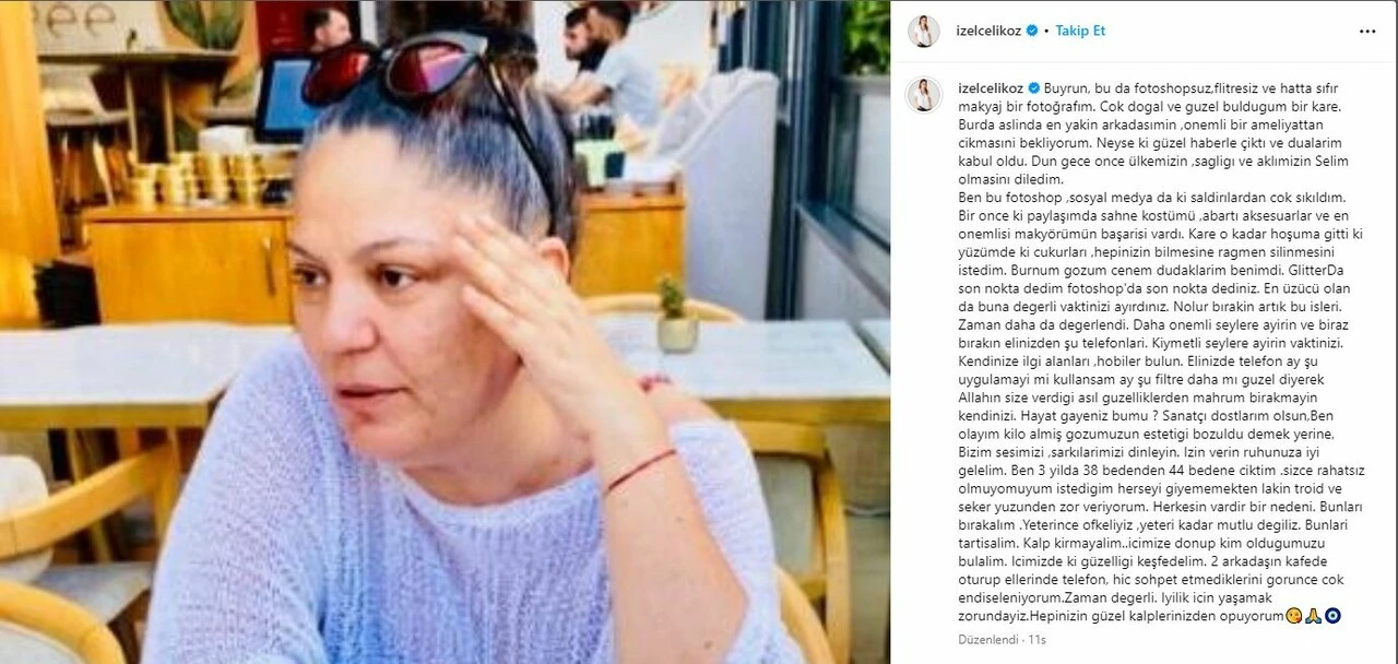 İzel makyajsız fotoğrafını paylaşıp isyan etti! Bırakın elinizden şu telefonları..