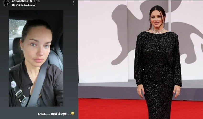 En pahalı otelde kalan Adriana Lima’nın odasını tahtakuruları bastı!